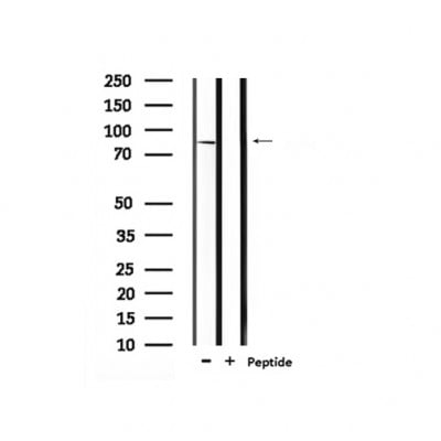 Rabbit Anti-MLK3 Polyclonal Antibody – Cat# MBS9614289