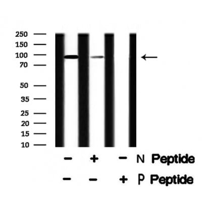 Rabbit Anti-MLK3 Polyclonal Antibody, Western Blot (WB) – Cat# MBS9614289
