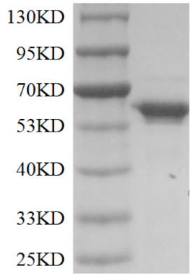 TdT Recombinant Protein – Cat# MBS9719251