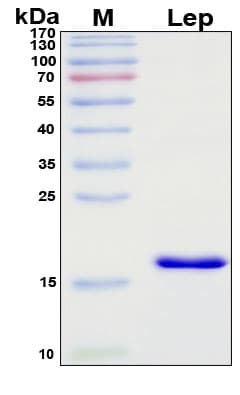 SDS-PAGE Image
