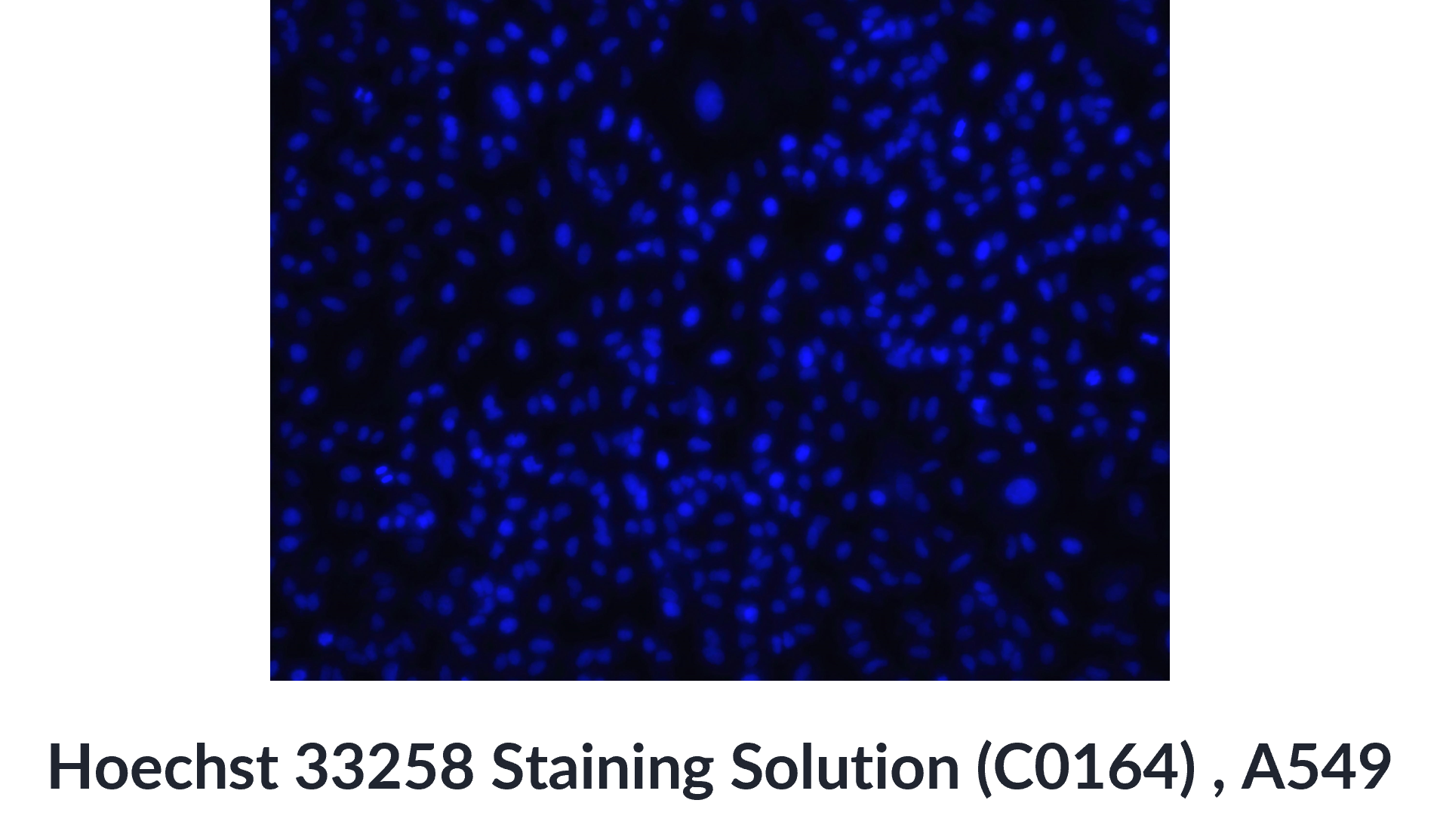  Hoechst 33258 Staining Solution