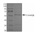 CAMKII beta/CAMK2B Protein, Human, Recombinant (His)