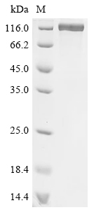Tau Protein, Mouse, Recombinant (His)