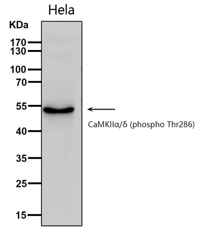 Anti-Phospho-CAMKII alpha/gamma (Thr286) Polyclonal Antibody