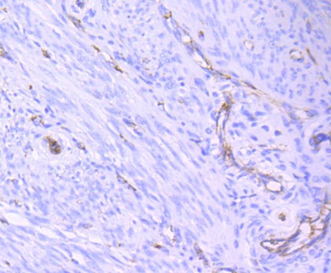 Anti-CD31 Antibody (6F18)