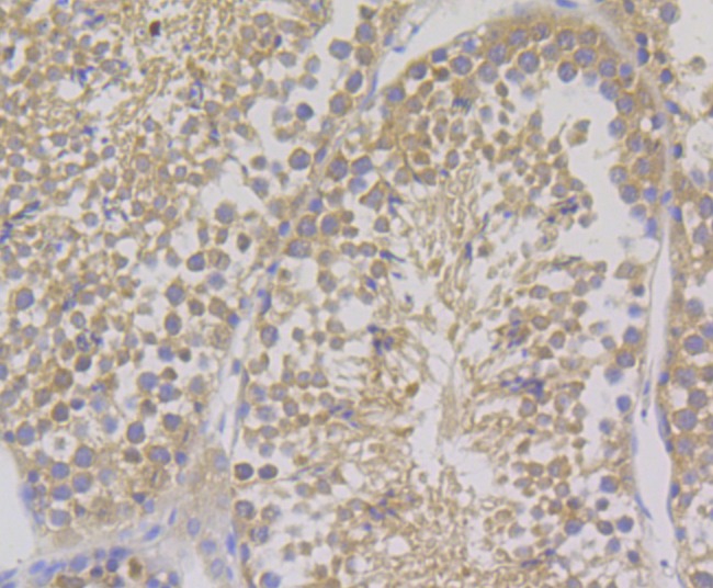 Anti-COMT Antibody (7B935)