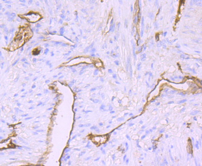 Anti-Claudin-5 Antibody (7Z609)