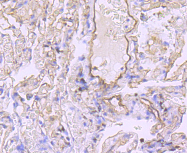 Anti-Claudin-5 Antibody (7Z609)