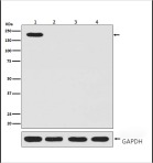 Anti-CRISPR-Cas9 Antibody (4K140)