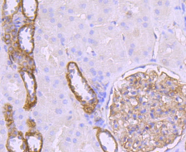 Anti-Claudin-5 Antibody (7Z609)
