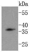 Anti-DKK1 Antibody (8S801)