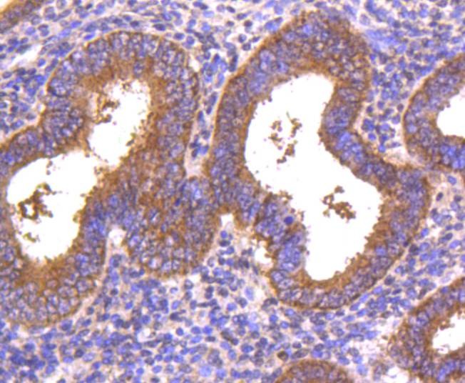 Anti-DKK1 Antibody (8S801)