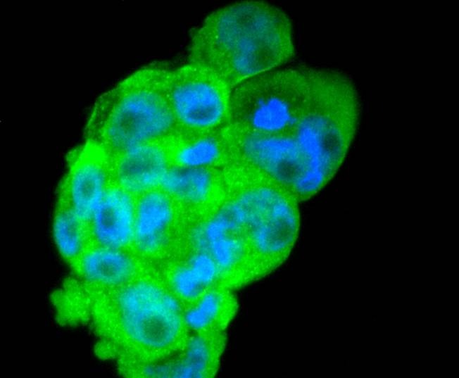 Anti-DKK1 Antibody (8S801)