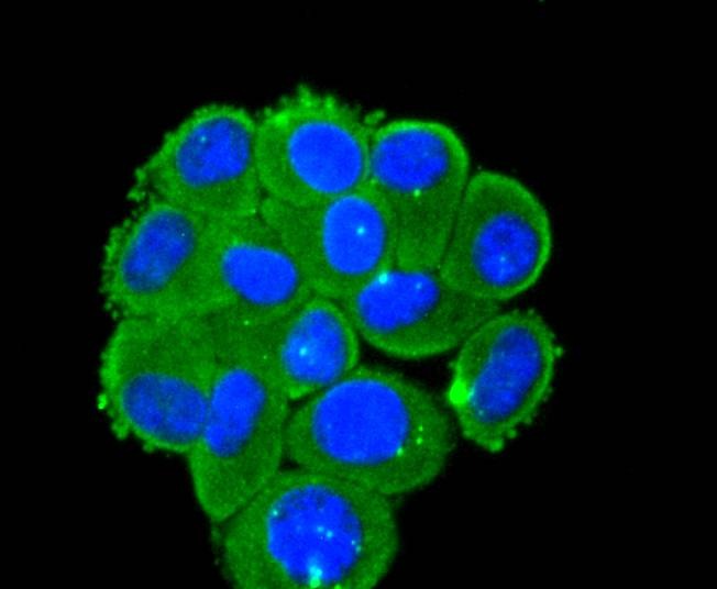 Anti-DKK1 Antibody (8S801)