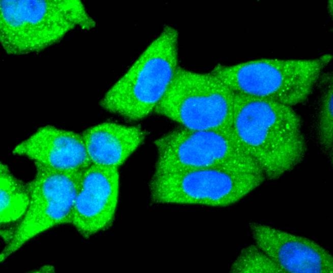 Anti-DKK1 Antibody (8S801)