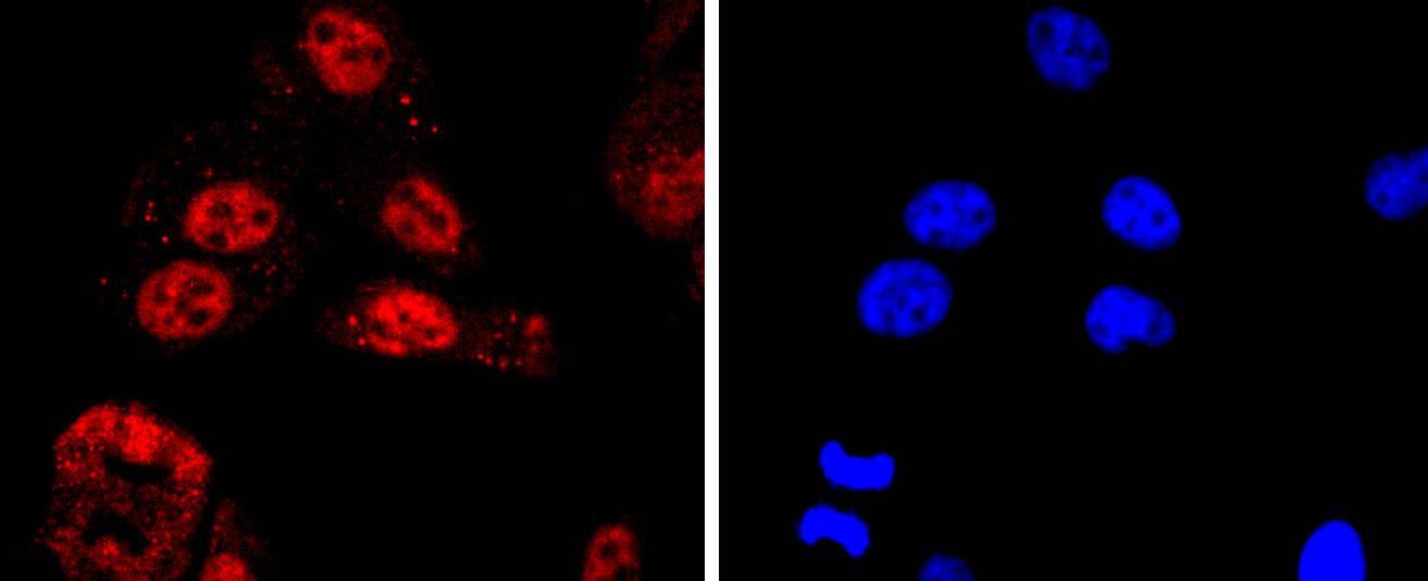 Anti-KLF4 Antibody (8B968)