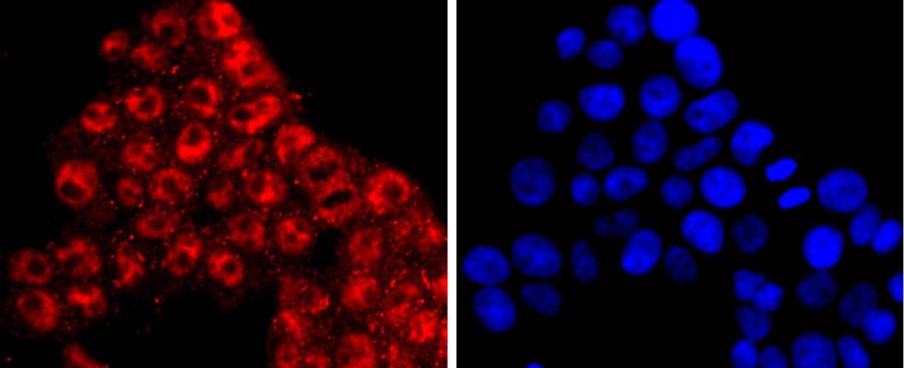 Anti-KLF4 Antibody (8B968)