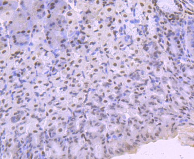 Anti-KLF4 Antibody (8B968)