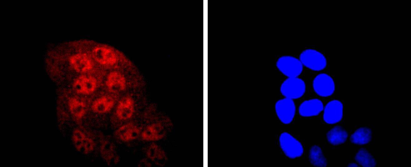 Anti-KLF4 Antibody (8B968)