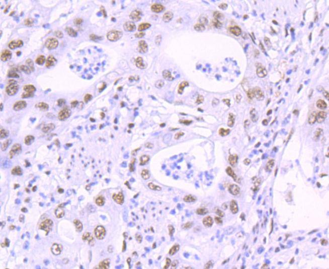 Anti-KLF4 Antibody (8B968)