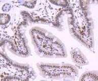 Anti-KLF4 Antibody (8B968)