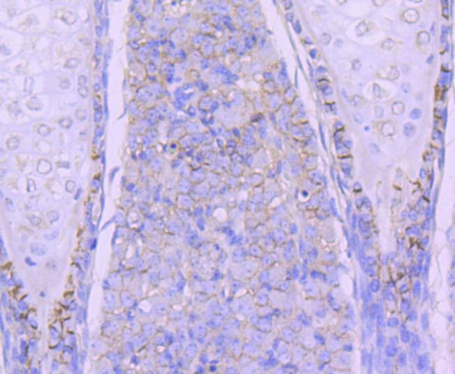 Anti-N Cadherin Antibody (2D207)