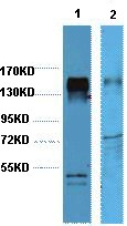 Anti-HER2/ERBB2 Antibody (6L396)