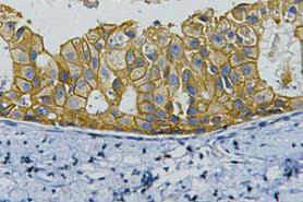 Anti-HER2/ERBB2 Antibody (6L396)