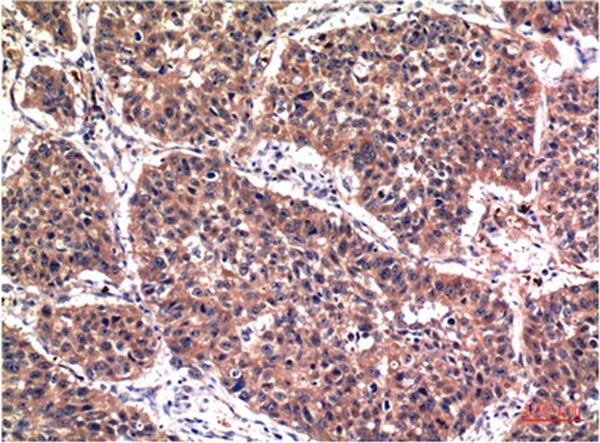 Anti-Phospho-AKT1 (S473) Antibody (1V445)