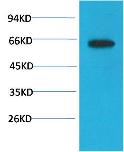 Anti-Phospho-AKT1 (S473) Antibody (1V445)