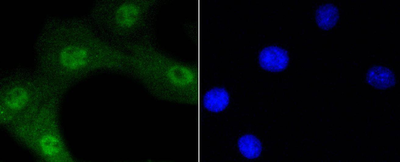 Anti-Phospho-AKT1 (Ser473) Antibody (6A70)