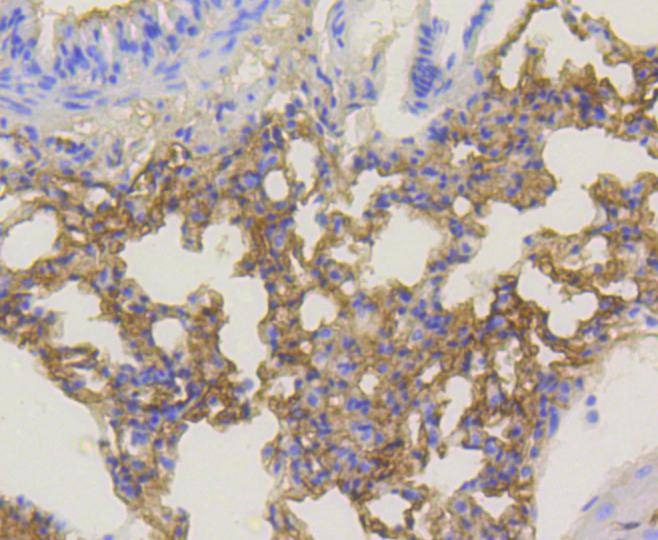 Anti-Phospho-AKT1 (Ser473) Antibody (6A70)