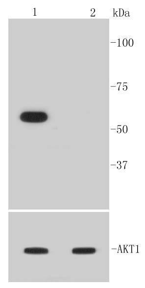 Anti-Phospho-AKT1 (Ser473) Antibody (6A70)