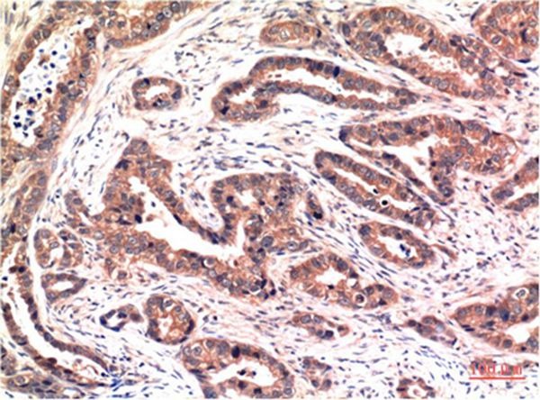 Anti-Phospho-AKT1 (S473) Antibody (1V445)