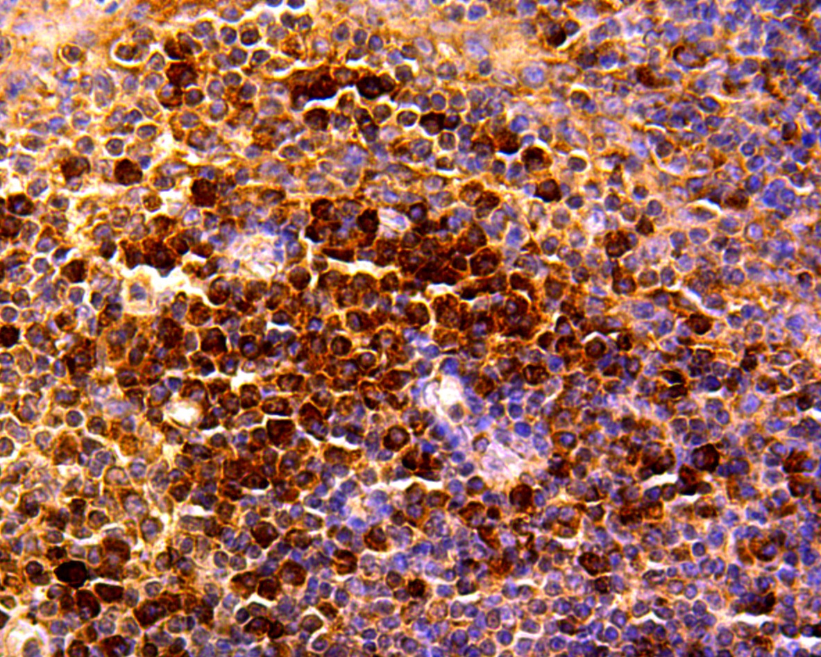 Anti-CCL5 Antibody (5P309)