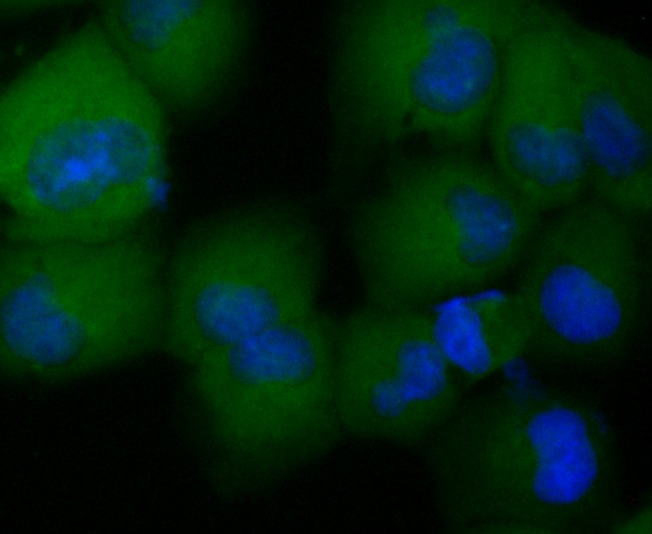 Anti-CCL5 Antibody (5P309)
