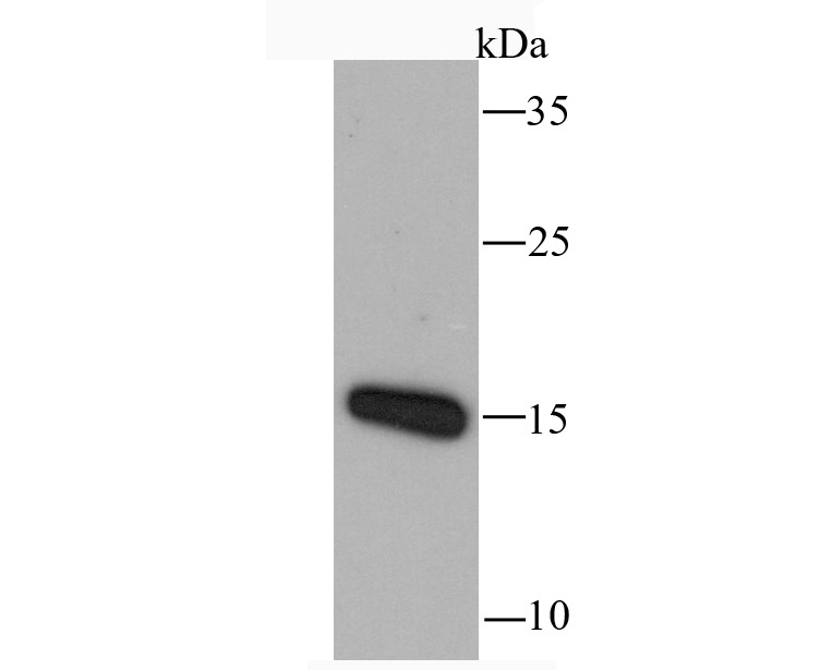 Anti-CCL5 Antibody (5P309)
