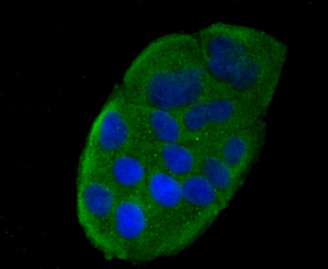 Anti-CCL5 Antibody (5P309)