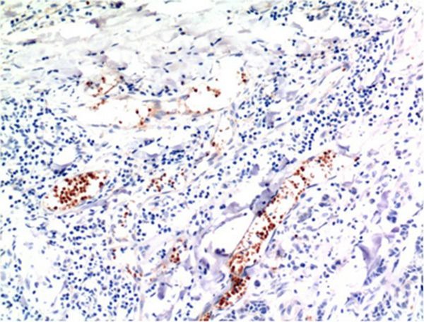 Anti-TGF beta 1 Antibody (4E12)