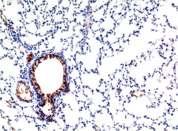 Anti-TGF beta 1 Antibody (4E12)