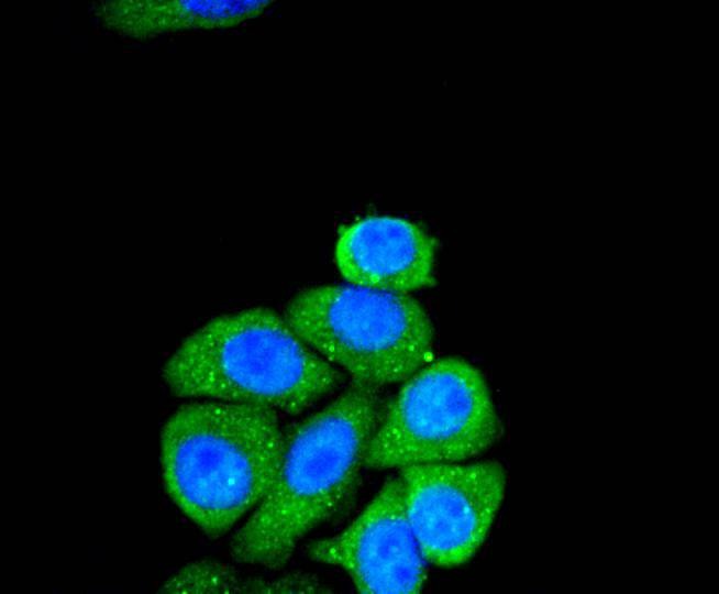 Anti-SMAD2 Antibody (4E423)