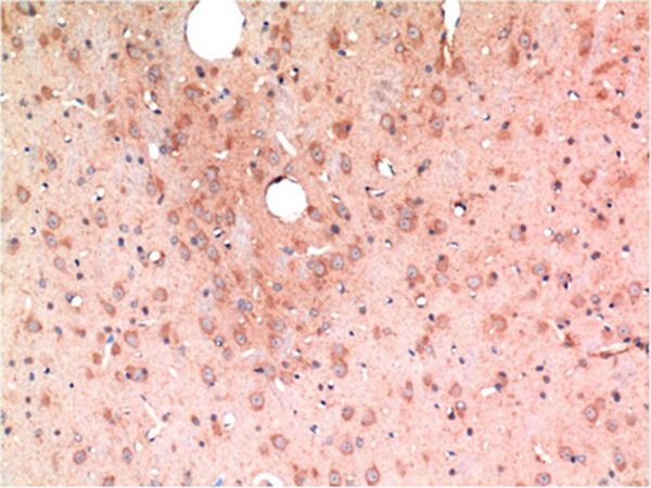 Anti-TGF beta 1 Antibody (4E12)