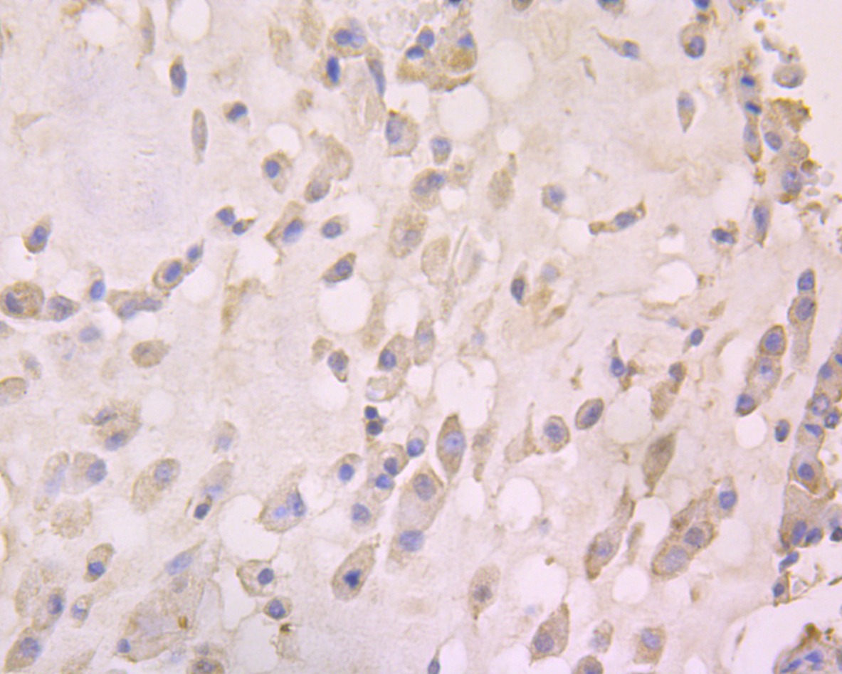 Anti-CCL5 Antibody (5P309)