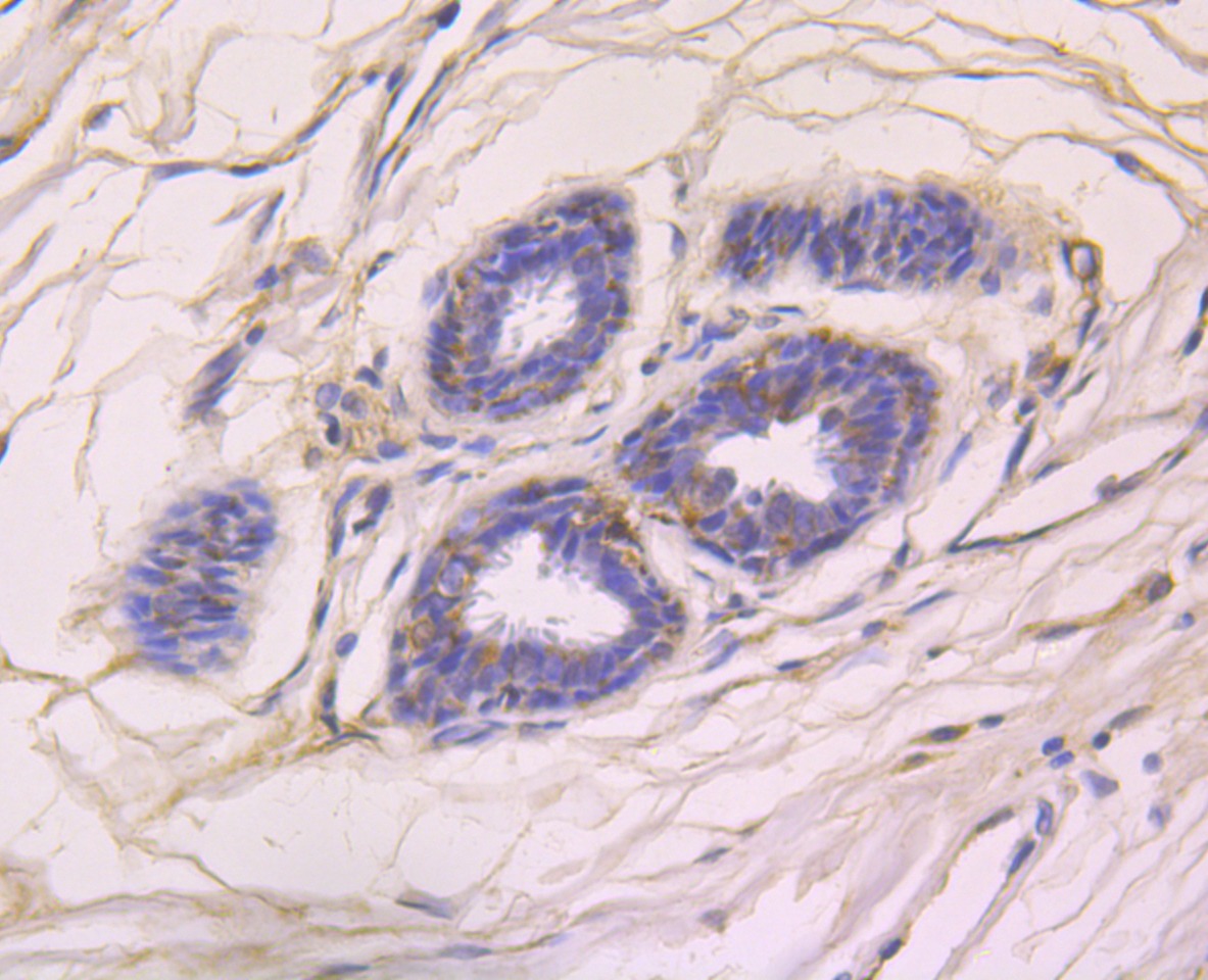 Anti-CCL5 Antibody (5P309)
