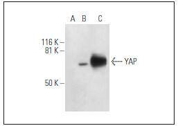 Anti-YAP1 Antibody (3O376)