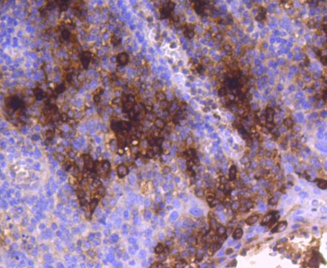 Anti-Mast Cell Tryptase Antibody (8D176)