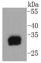 Anti-Mast Cell Tryptase Antibody (8D176)
