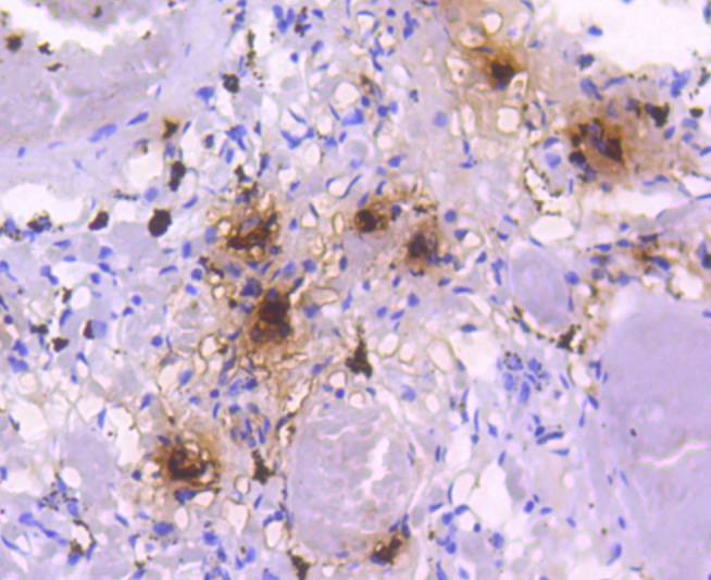 Anti-Mast Cell Tryptase Antibody (8D176)