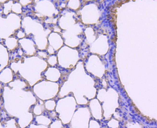 Anti-Mast Cell Tryptase Antibody (8D176)