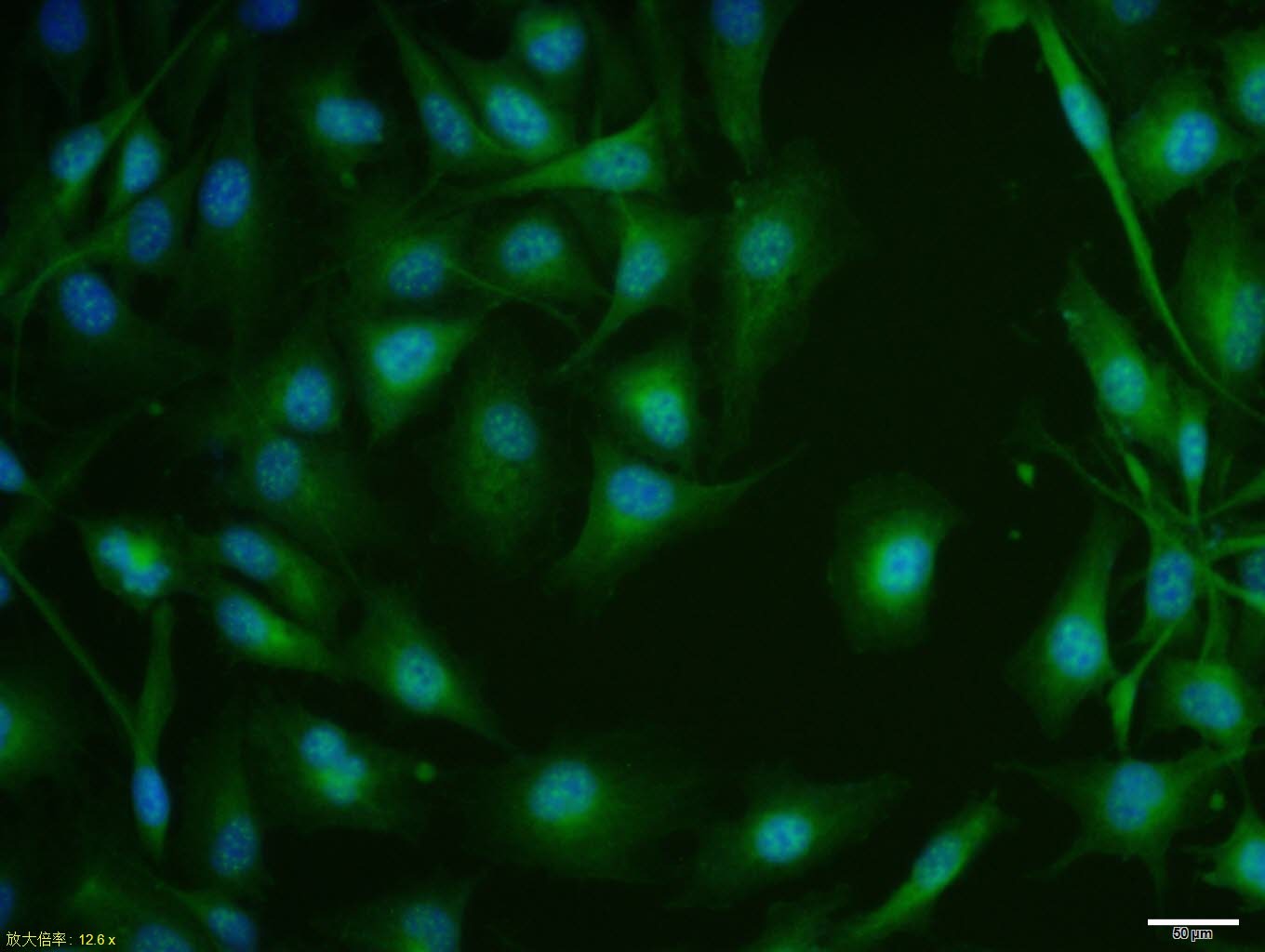 Anti-ASCL2 Polyclonal Antibody